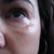 Sculptra Community Photo