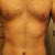 Slim Lipo Community Photo