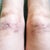 Mesotherapy Community Photo