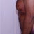 Male Breast Reduction Community Photo