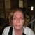 Laser Resurfacing Community Photo