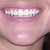 Permanent Makeup Community Photo