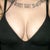 Breast Augmentation Community Photo