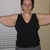 Arm Lift Community Photo
