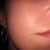 Scars Treatment Community Photo