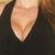 Breast Augmentation Community Photo