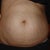 SmartLipo MPX Community Photo