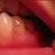 Teeth Whitening Community Photo