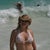 Tummy Tuck Community Photo