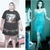 Gastric Bypass Community Photo