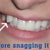 Invisalign Community Photo