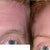 Botox Community Photo