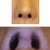 Asian Rhinoplasty Community Photo