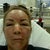 Glycolic Peel Community Photo