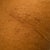 Lipoma Removal Community Photo
