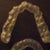 Invisalign Community Photo