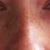 this is my nose from the front before
