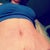 here's a good look at my residual stretch marks and BB. just happy to be smooth and flat!
