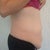 side view before.I will be glad when there isnt anymore skin to roll my underwear down anymore