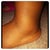 swollen ankles ;( aka cankles