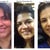 Some comparison. The first two left pictures are examples of previous nose. The far right is at 3 weeks (2 days after steroid shot)
