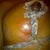 If you look closely, this was my left breast and you can see the redness along my vertical incision. EVERYTHING will look abnormal to you after surgery, but look for redness and warmth, because those are signs of infection.