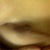 This is it healed