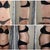 Week 3 post op vs. before
