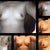 Big Picture is pre op- 12/19/2012
Top right: 12/31/2012 PO 3 days, Second from the top: 1/7/2013 PO Week 1, Bottom left: 1/12/2013 PO Week 2, Bottom Middle: 1/19/2013 PO Week 3, Skipped Week 4 opps!, Bottom right: 2/1/2013 PO Week 5.