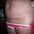 10-31-11 before surgery ~ C-Section Cut
