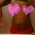 stretch marks everywhere