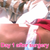 after surgery