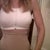 8 days post op. This is the compression sports bra I love. www.prettier.com is the website on the tag. I bought it at Dillards. I am also wearing spanx slim cognito. I will take pictures of my body without compression garments when I purchase new lingerie. None of my regular old bras fit and I didn't want to get any new ones until my both of my breasts settle. Swelling seems to be gone but the left one has not dropped completely.