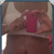 more pads around my waist @2 weeks