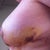 other side, more bruising
