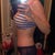 12 weeks post op