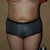 Day 3 Post Op Front