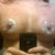 3rd day post op. i think they look great! (considering) my left nipple is numb which worries me but im sure the feeling will come back with time.