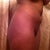 Pre