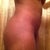 8wk post