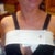 At Dr's office this morning (Day 2), with strap