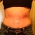 After Front 5 Weeks PO
