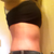 After Side :) 5 Weeks po