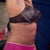 Left Side 11 Dec 2012! No exercising since I had the treatment in 2009!