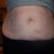 This is alot of loose skin
