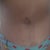 Belly button- 3 months