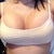 11 days post op
