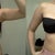 side by side comparison, 9 days post on picture 1, 26 days post op pic 2. note that the "square look" on the upper pole is gone!