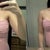 same tube top. 26 days post op on first pic, 9 days post op on second one. boobs are looking more natural and even appear softer, dropped some and no longer sitting very high on my chest