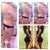 Left pic is me now. Top left is with lipo app only. Top right is with lipo app AND butt projection. The low right pic looks pretty similar in waist/booty.